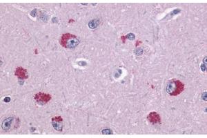 Anti-TAAR1 antibody  ABIN1049378 IHC staining of human brain, neurons. (TAAR1 anticorps  (Extracellular Domain))