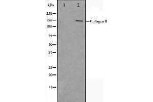 Western blot analysis on COLO205 cell lysate using Collagen II Antibody,The lane on the left is treated with the antigen-specific peptide.