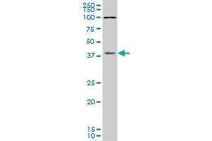BOLL monoclonal antibody (M05), clone 5B8.
