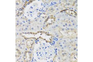 Immunohistochemistry of paraffin-embedded rat kidney using B9D1 antibody (ABIN5975680) at dilution of 1/100 (40x lens). (B9D1 anticorps)