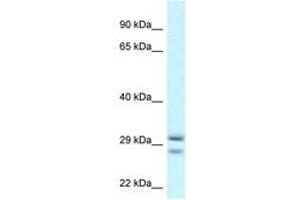 Image no. 1 for anti-Ras-Like Without CAAX 1 (RIT1) (AA 108-157) antibody (ABIN6747637) (RIT1 anticorps  (AA 108-157))