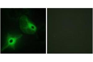 Immunofluorescence analysis of HeLa cells, using KSR2 Antibody. (KSR2 anticorps  (AA 671-720))