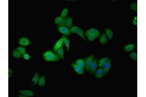 Immunofluorescent analysis of HepG2 cells using ABIN7144131 at dilution of 1:100 and Alexa Fluor 488-congugated AffiniPure Goat Anti-Rabbit IgG(H+L)