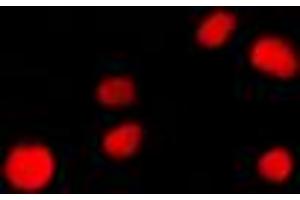 Immunofluorescent analysis of NUP160 staining in NIH3T3 cells. (NUP160 anticorps  (Center))