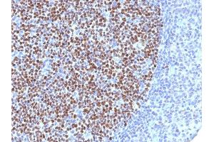 Formalin-fixed, paraffin-embedded human Tonsil stained with BCL-6 Mouse Monoclonal Antibody (BCL6/1527).