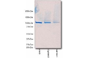 SDS-PAGE/Coomassie Blue staining of poly(ADP-ribose) automodified PARP1. (PARP1 Protéine)