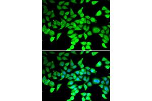 Immunofluorescence analysis of MCF-7 cells using HDAC7 antibody (ABIN5974387). (HDAC7 anticorps)