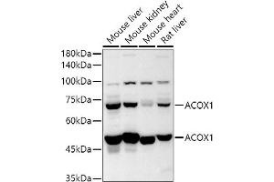 Western blot analysis of extracts of various cell lines, using  antibody (ABIN6131168, ABIN6136442, ABIN6136443 and ABIN6224114) at 1:500 dilution. (ACOX1 anticorps  (AA 1-270))