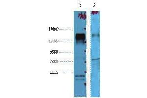 Western Blotting (WB) image for anti-Receptor tyrosine-protein kinase erbB-2 (ErbB2/Her2) antibody (ABIN3188001) (ErbB2/Her2 anticorps)