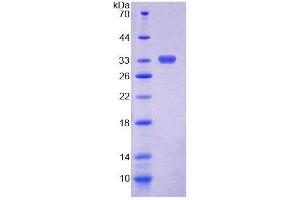 SDS-PAGE analysis of Human CHIT1 Protein.