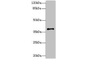 Western blot All lanes: PLCXD1 antibody at 2 μg/mL + Jurkat whole cell lysate Secondary Goat polyclonal to rabbit IgG at 1/10000 dilution Predicted band size: 37 kDa Observed band size: 37 kDa (PLCXD1 anticorps  (AA 1-323))
