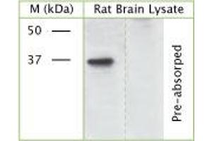 WB on rat brain lysate using Rabbit antibody to phospho S41 of Axonal membrane protein GAP-43 (Neuromodulin, growth-associated protein 43): IgG (ABIN350110) at 50 µg/ml concentration incubated overnight at 4°C. (GAP43 anticorps  (pSer41))