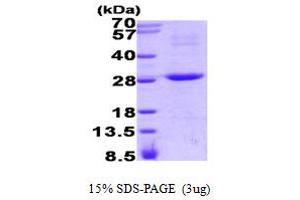 SDS-PAGE (SDS) image for Regulator of G-Protein Signaling 16 (RGS16) (AA 1-202) protein (His tag) (ABIN667771)