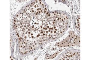 ABIN6267372 at 1/200 staining human testis tissue sections by IHC-P.