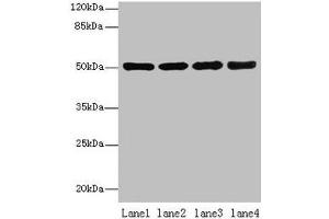 Western blot All lanes: CEACAM1 antibody at 10 μg/mL Lane 1: HT29 whole cell lysate Lane 2: HCT116 whole cell lysate Lane 3: COLO205 whole cell lysate Lane 4: HepG2 whole cell lysate Secondary Goat polyclonal to rabbit IgG at 1/10000 dilution Predicted band size: 58, 46, 36, 39, 51, 47, 28, 44, 52, 40 kDa Observed band size: 51 kDa (CEACAM1 anticorps  (AA 35-428))