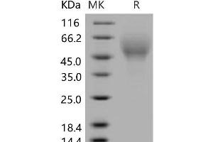 Western Blotting (WB) image for CD200 Receptor 4 (CD200R4) protein (His tag) (ABIN7320208)