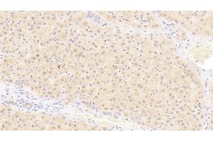 Detection of IL23a in Human Liver Tissue using Polyclonal Antibody to Interleukin 23 Subunit Alpha (IL23a)