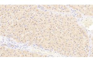 Detection of IL23a in Human Liver Tissue using Polyclonal Antibody to Interleukin 23 Subunit Alpha (IL23a) (IL23A anticorps  (AA 20-189))