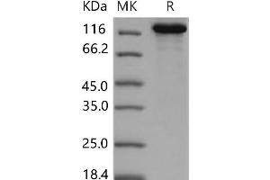 Western Blotting (WB) image for Contactin Associated Protein-Like 2 (CNTNAP2) (Active) protein (His tag) (ABIN7320203)