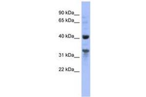 Image no. 1 for anti-Mitochondrial Ribosomal Protein L37 (MRPL37) (AA 35-84) antibody (ABIN6741668) (MRPL37 anticorps  (AA 35-84))