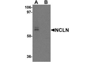 Western blot analysis of NCLN in mouse heart tissue lysate with NCLN antibody at 0. (Nicalin anticorps  (C-Term))