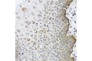 Immunohistochemistry of paraffin-embedded human esophagus using FANCL antibody. (FANCL anticorps)