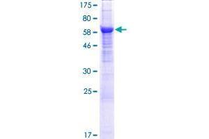 Image no. 1 for Adipocyte Plasma Membrane Associated Protein (APMAP) (AA 1-416) protein (GST tag) (ABIN1347426)
