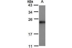 WB Image Sample(30 μg of whole cell lysate) A:MOLT4, 15% SDS PAGE antibody diluted at 1:500 (SRI anticorps)
