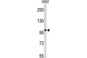 Western Blotting (WB) image for anti-Heat Shock 105kDa/110kDa Protein 1 (HSPH1) antibody (ABIN3001677) (HSPH1 anticorps)