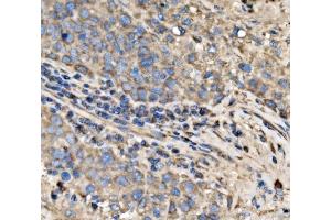 IHC analysis of RPL17 using anti-RPL17 antibody (ABIN7601639).