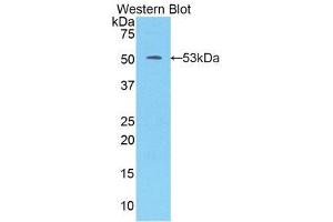 Western Blotting (WB) image for anti-Kallikrein 7 (KLK7) (AA 23-253) antibody (ABIN1859557) (Kallikrein 7 anticorps  (AA 23-253))