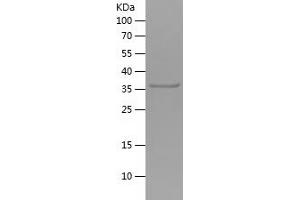 Western Blotting (WB) image for C-Type Lectin Domain Family 9, Member A (CLEC9A) (AA 100-209) protein (His tag) (ABIN7122064)