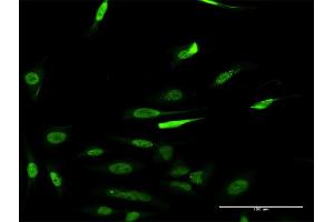 Immunofluorescence of monoclonal antibody to RCC1 on HeLa cell.