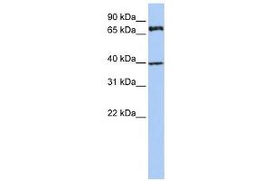 Western Blotting (WB) image for anti-Membrane Protein, Palmitoylated 5 (MAGUK P55 Subfamily Member 5) (MPP5) antibody (ABIN2458687) (MPP5 anticorps)