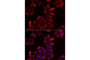 Immunofluorescence analysis of U2OS cells using PDLIM1 antibody (ABIN5974031). (PDLIM1 anticorps)