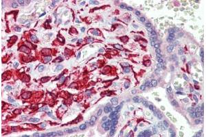 Human Placenta (formalin-fixed, paraffin-embedded) stained with TEAD1 antibody ABIN462220 followed by biotinylated goat anti-rabbit IgG secondary antibody ABIN481713, alkaline phosphatase-streptavidin and chromogen.