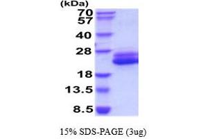 SDS-PAGE (SDS) image for Interleukin 6 (IL6) (AA 30-212) (Active) protein (His tag) (ABIN7281097)