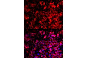 Immunofluorescence analysis of U2OS cells using QARS antibody.