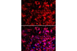 Immunofluorescence analysis of U2OS cells using QARS antibody. (QARS anticorps  (AA 1-250))