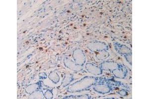 IHC-P analysis of Human Stomach Tissue, with DAB staining. (TPSAB1 anticorps  (AA 161-262))