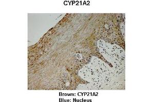 Sample Type : Monkey vagina  Primary Antibody Dilution :  1:25  Secondary Antibody: Anti-rabbit-HRP  Secondary Antibody Dilution:  1:1000  Color/Signal Descriptions: Brown: CYP21A2 Blue: Nucleus  Gene Name: CYP21A2  Submitted by: Jonathan Bertin, Endoceutics Inc. (CYP21A2 anticorps  (C-Term))