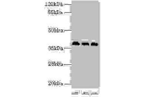 Western blot All lanes: HNRNPD antibody at 2 μg/mL Lane 1: 293T whole cell lysate Lane 2: Hela whole cell lysate Lane 3: Jurkat whole cell lysate Secondary Goat polyclonal to rabbit IgG at 1/10000 dilution Predicted band size: 39, 37, 33, 31 kDa Observed band size: 39 kDa (HNRNPD/AUF1 anticorps  (AA 18-355))