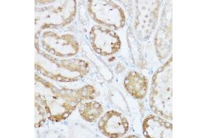 Immunohistochemistry of paraffin-embedded rat kidney using NEURL1B Rabbit pAb (ABIN7268857) at dilution of 1:100 (40x lens). (NEURL1B anticorps)