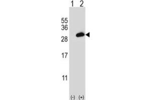 Western Blotting (WB) image for anti-Proteasome (Prosome, Macropain) Activator Subunit 2 (PA28 Beta) (PSME2) antibody (ABIN3002751) (PSME2 anticorps)