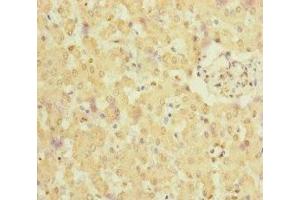 Immunohistochemistry of paraffin-embedded human liver tissue using ABIN7165719 at dilution of 1:100