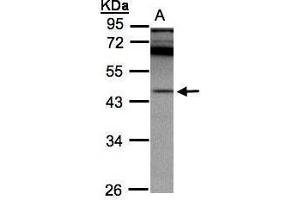 WB Image Sample(30 ug whole cell lysate) A:A431, 10% SDS PAGE antibody diluted at 1:2000 (SCPEP1 anticorps)