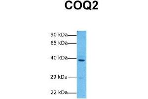 Host:  Rabbit  Target Name:  COQ2  Sample Tissue:  Human MCF7  Antibody Dilution:  1. (COQ2 anticorps  (Middle Region))