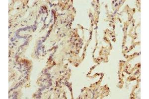 Immunohistochemistry of paraffin-embedded human lung tissue using ABIN7159816 at dilution of 1:100