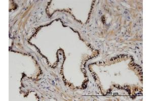 Immunoperoxidase of monoclonal antibody to ZHX3 on formalin-fixed paraffin-embedded human prostate. (ZHX3 anticorps  (AA 863-955))