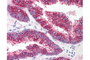 Anti-TLR5 antibody IHC of human prostate. (TLR5 anticorps  (Internal Region))